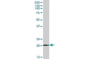 COMMD1 MaxPab polyclonal antibody. (COMMD1 Antikörper  (AA 1-190))