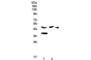 Western blot testing of 1) rat pancreas and 2) mouse pancreas lysate with Carboxypeptidase A antibody at 0. (CPA Antikörper)