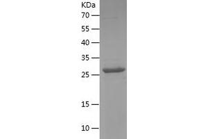 Aquaporin 1 Protein (AA 208-269) (His-IF2DI Tag)