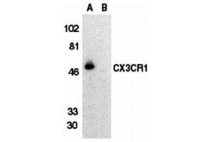 Western Blotting (WB) image for anti-Chemokine (C-X3-C Motif) Receptor 1 (CX3CR1) (Extracellular Loop) antibody (ABIN1030840) (CX3CR1 Antikörper  (Extracellular Loop))