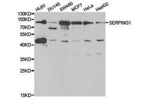 Western Blotting (WB) image for anti-Serpin Peptidase Inhibitor, Clade G (C1 Inhibitor), Member 1 (SERPING1) antibody (ABIN1874741) (SERPING1 Antikörper)