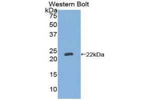 Western Blotting (WB) image for anti-Linker For Activation of T Cells Family, Member 2 (LAT2) (AA 32-192) antibody (ABIN7439777)