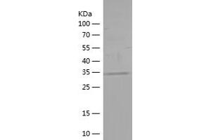 Ataxin 2 Protein (ATXN2) (AA 1-165) (His tag)