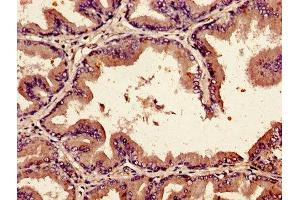 Immunohistochemistry of paraffin-embedded human prostate tissue using ABIN7145684 at dilution of 1:100 (BMP2 Antikörper  (AA 283-396))