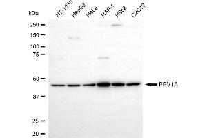 Western blotting analysis using PPM1A antibody (ABIN7800032).