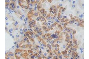 DAB staining on IHC-P; Samples: Human Kidney Tissue (ADCY9 Antikörper  (AA 1029-1282))