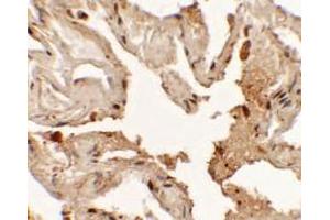 Immunohistochemistry of NKX2-1 in human lung tissue with NKX2-1 antibody at 2. (NKX2-1 Antikörper  (N-Term))