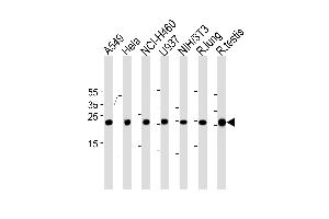 Rat Cebpd Antibody (Center) (ABIN1881715 and ABIN2843454) western blot analysis in A549,Hela,NCI-,U-937,mouse NIH/3T3 cell line and rat lung,testis tissue lysates (35 μg/lane). (CEBPD Antikörper  (AA 161-189))