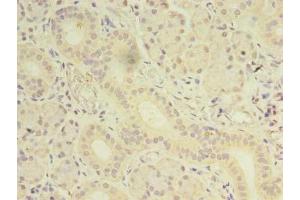Immunohistochemistry of paraffin-embedded human pancreatic tissue using ABIN7165891 at dilution of 1:100 (OSR2 Antikörper  (AA 101-276))