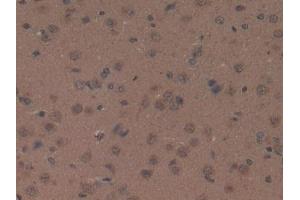 DAB staining on IHC-P; Samples: Rat Brain Tissue (Orexin A Antikörper  (AA 32-123))