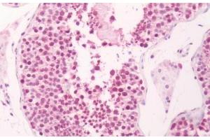 Immunohistochemistry (IHC) image for anti-Prostaglandin E Synthase (PTGES) (Cytoplasmic Domain) antibody (ABIN1923233)
