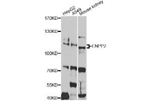 Western blot analysis of extracts of various cell lines, using ENPP2 antibody. (ENPP2 Antikörper)