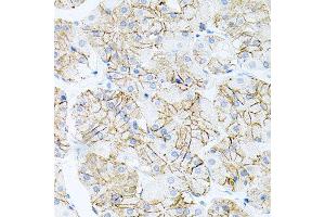 Immunohistochemistry of paraffin-embedded human stomach using IL17A antibody at dilution of 1:100 (x40 lens). (Interleukin 17a Antikörper)