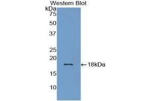 Detection of Recombinant BMP15, Rat using Polyclonal Antibody to Bone Morphogenetic Protein 15 (BMP15) (BMP15 Antikörper  (AA 269-391))