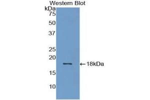 Detection of Recombinant BMP15, Rat using Polyclonal Antibody to Bone Morphogenetic Protein 15 (BMP15)