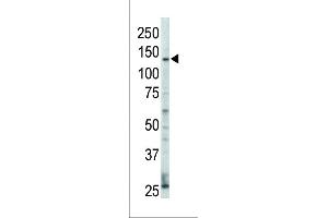 Western blot analysis of anti-ErbB4 Pab (ABIN391950 and ABIN2841748) in HL60 cell lysate. (ERBB4 Antikörper  (N-Term))