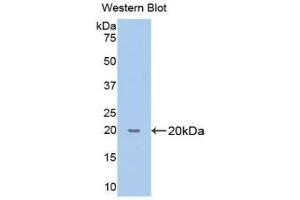 Western blot analysis of the recombinant protein. (PPIB Antikörper  (AA 47-216))