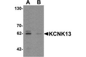 Western blot analysis of KCNK13 in rat brain tissue lysate with KCNK13 Antibody  at 0. (KCNK13 Antikörper  (Middle Region))
