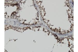 Immunostaining (ISt) image for anti-PDZ Binding Kinase (PBK) (AA 1-110) antibody (ABIN527755)