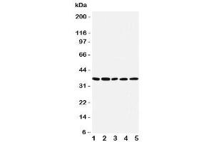 Western blot testing of IRF1 antibody and Lane 1:  COLO320 (IRF1 Antikörper  (Middle Region))