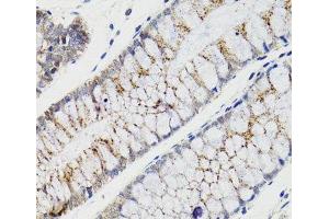 Immunohistochemistry of paraffin-embedded Human rectum using CHMP4B Polyclonal Antibody at dilution of 1:100 (40x lens). (CHMP4B Antikörper)