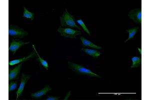 Immunofluorescence of purified MaxPab antibody to CALCB on HeLa cell. (CALCB Antikörper  (AA 1-127))