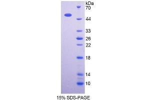 SDS-PAGE analysis of Human OXCT1 Protein. (OXCT1 Protein)