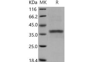Western Blotting (WB) image for Acid Phosphatase 5, Tartrate Resistant (ACP5) (Active) protein (His tag) (ABIN7194093) (ACP5 Protein (His tag))