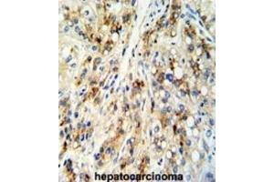 Immunohistochemistry (IHC) image for anti-Cat Eye Syndrome Chromosome Region, Candidate 5 (CECR5) antibody (ABIN3003803) (CECR5 Antikörper)