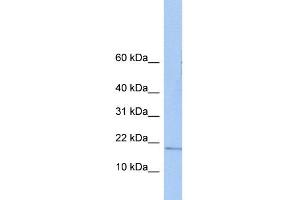 WB Suggested Anti-ZNHIT3 Antibody Titration:  0. (ZNHIT3 Antikörper  (N-Term))