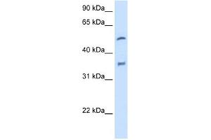 WB Suggested Anti-CYP2D6 Antibody Titration:  2. (CYP2D6 Antikörper  (N-Term))
