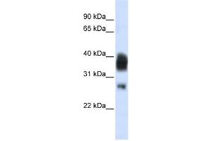 RNASEH1 antibody used at 1 ug/ml to detect target protein.