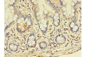 Immunohistochemistry of paraffin-embedded human small intestine tissue using ABIN7163864 at dilution of 1:100 (GALNT14 Antikörper  (AA 1-552))