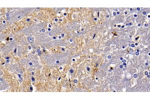 Immunohistochemistry (IHC) image for anti-Toll-Like Receptor 5 (TLR5) (AA 325-644) antibody (ABIN7444148)