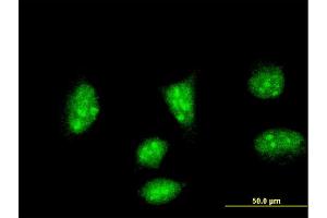 Immunofluorescence of monoclonal antibody to HAND2 on HeLa cell. (HAND2 Antikörper  (AA 135-216))