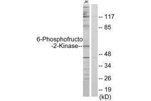 Western blot analysis of extracts from Jurkat cells, using PFKFB2 antibody. (PFKFB2 Antikörper  (N-Term))