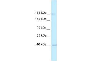 WB Suggested Anti-RGD1563533 Antibody   Titration: 1. (CASZ1 Antikörper  (Middle Region))