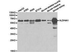 Western Blotting (WB) image for anti-Aldehyde Dehydrogenase 4 Family, Member A1 (ALDH4A1) antibody (ABIN1870929) (ALDH4A1 Antikörper)