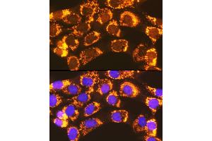 Immunofluorescence analysis of NIH-3T3 cells using  Rabbit pAb (ABIN7265423) at dilution of 1:100 (40x lens).