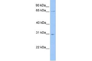 WB Suggested Anti-NR1D2 Antibody Titration:  0. (NR1D2 Antikörper  (N-Term))