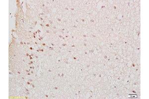 Immunohistochemistry (Paraffin-embedded Sections) (IHC (p)) image for anti-GTP-Binding Protein 10 (GTPBP10) (AA 151-250) antibody (ABIN750748)