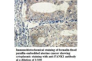Image no. 1 for anti-Fibronectin Type III and Ankyrin Repeat Domains 1 (FANK1) antibody (ABIN1576454) (FANK1 Antikörper)