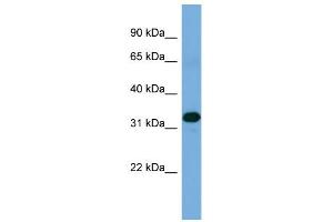 WB Suggested Anti-ZNF511 Antibody Titration: 0. (ZNF511 Antikörper  (Middle Region))
