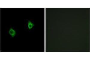 Immunofluorescence analysis of A549 cells, using RPS9 Antibody. (RPS9 Antikörper  (AA 31-80))