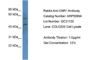 Western Blotting (WB) image for anti-Cannabinoid Receptor 1 (CNR1) (N-Term) antibody (ABIN786077) (CNR1 Antikörper  (N-Term))