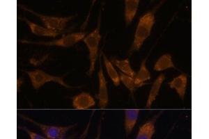 Immunofluorescence analysis of L929 cells using STAR Polyclonal Antibody at dilution of 1:100 (40x lens). (STAR Antikörper)