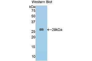 Western blot analysis of the recombinant protein. (GLB1 Antikörper  (AA 192-432))