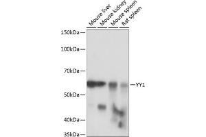 Western blot analysis of extracts of various cell lines, using YY1 antibody (ABIN7271428) at 1:1000 dilution. (YY1 Antikörper)