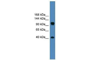 Western Blot showing CNTN1 antibody used at a concentration of 1-2 ug/ml to detect its target protein.