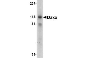 Western blot analysis of Daxx in 293 total cell lysate with AP30275PU-N Dax antibody at 1 mg/ml.
